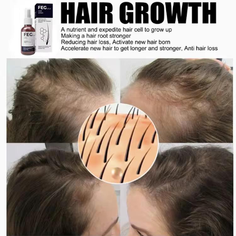 FEG Plus Hair Growth Serum Hair-loss Treatment 14 Days Best Ginger Anti Hair Loss Serum